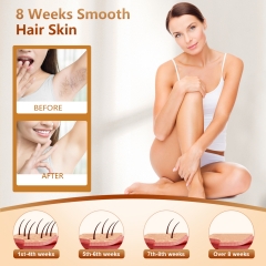 G995 IPL Hair Removal With 0 Degree Ice Application With Extra Large Display Screen